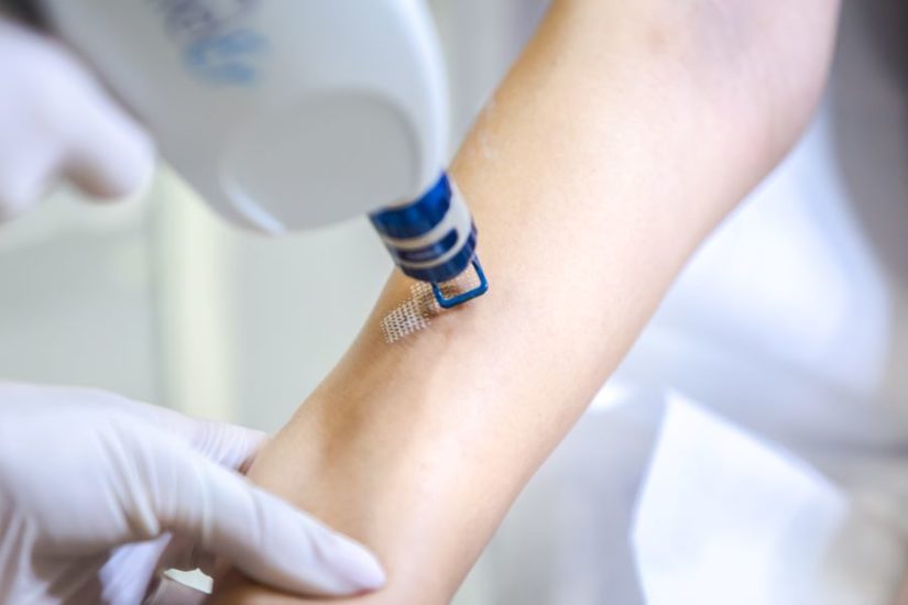 Procedure & Costs of Laser Scar Removal Comparisonsmaster