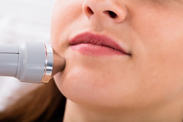 electrolysis facial hair removal